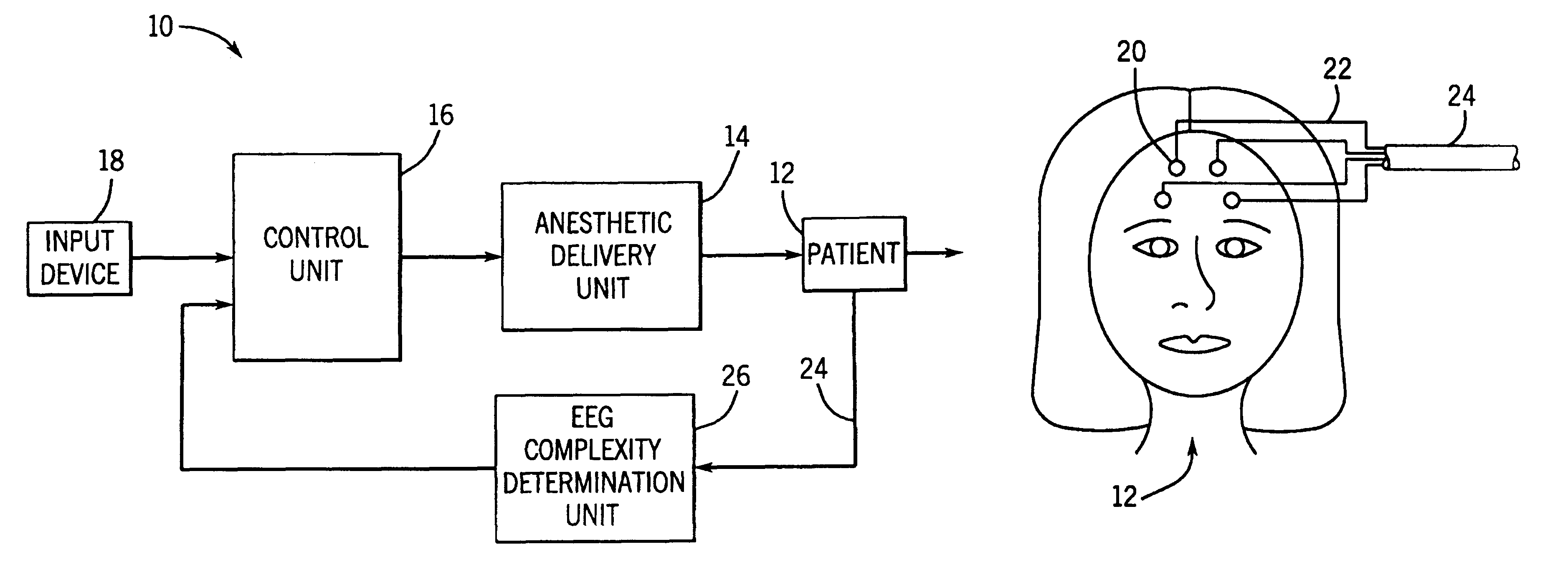 Closed loop drug administration method and apparatus using EEG complexity for control purposes