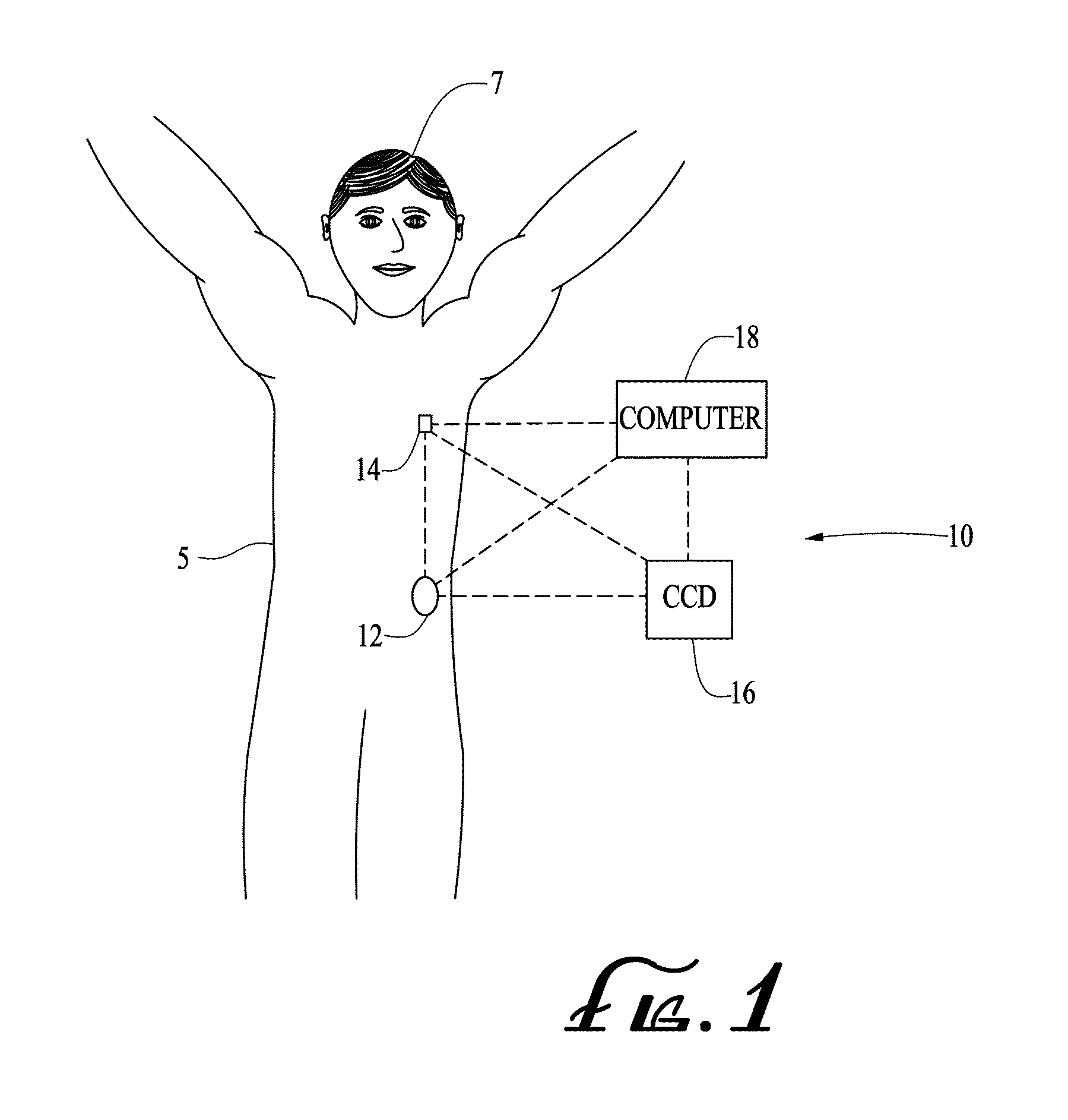 Transfer guard systems and methods