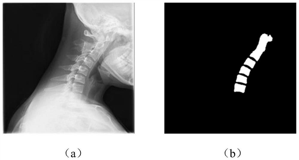 Cervical vertebra image quality evaluation method, electronic equipment and storage medium