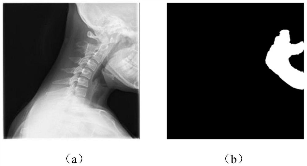 Cervical vertebra image quality evaluation method, electronic equipment and storage medium