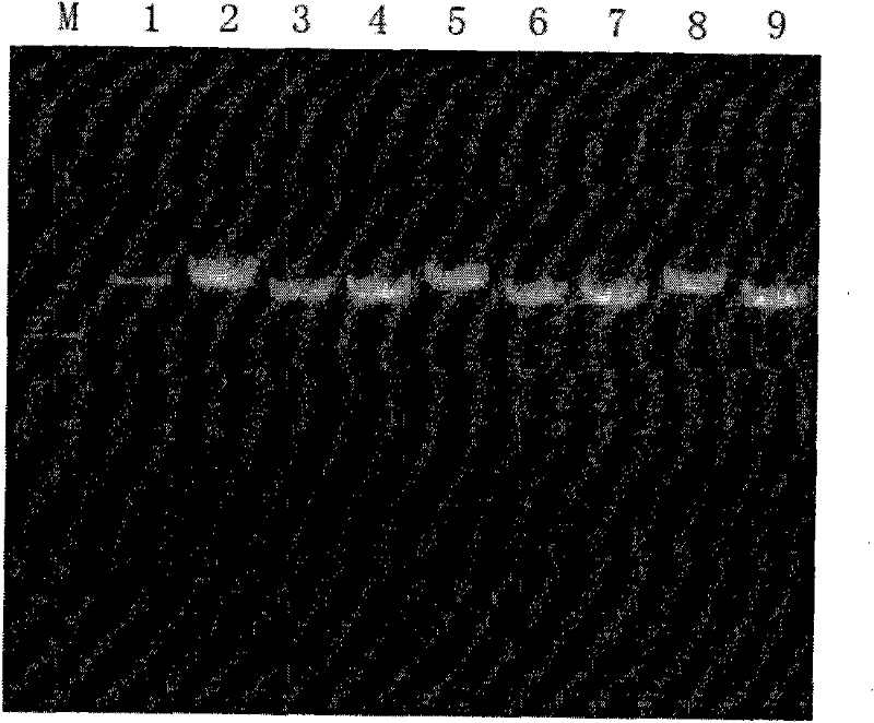 Construction and application of RNA interference expression vector of targeted ZNF268 gene