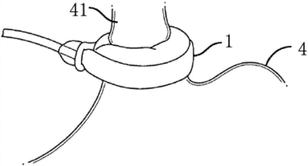 Adjustment device and method for adjusting injection port position of implanted tissue