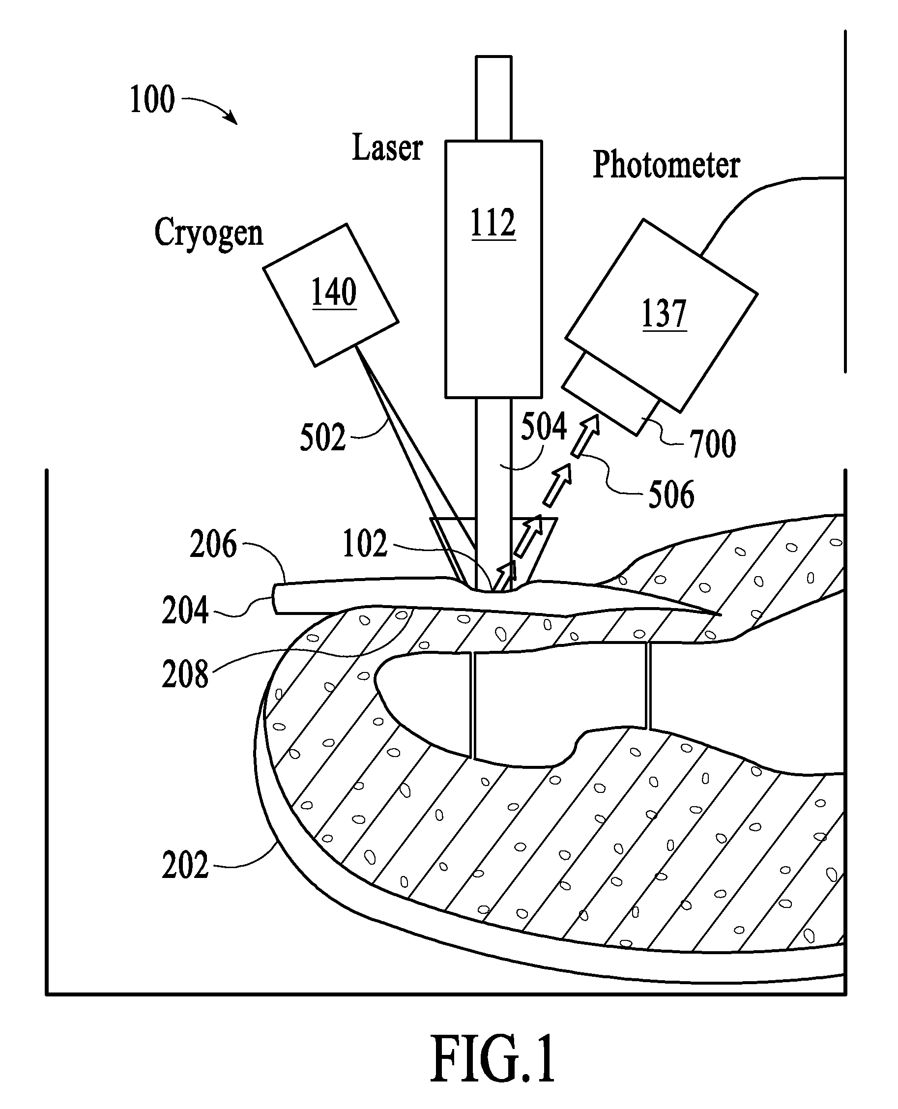 Method for treatment of fingernail and toenail microbial infections using infrared laser heating and low pressure