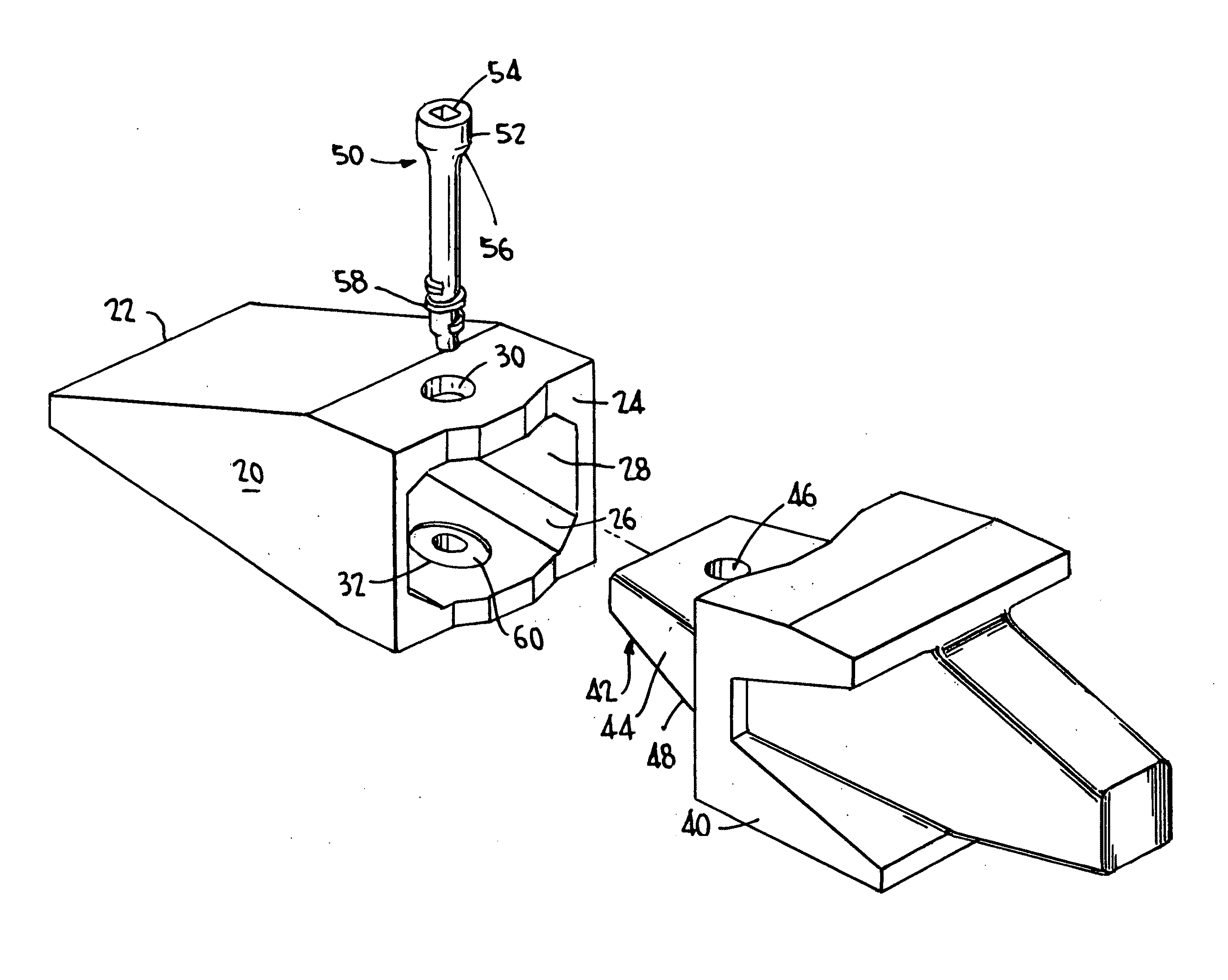 Excavation retention assembly