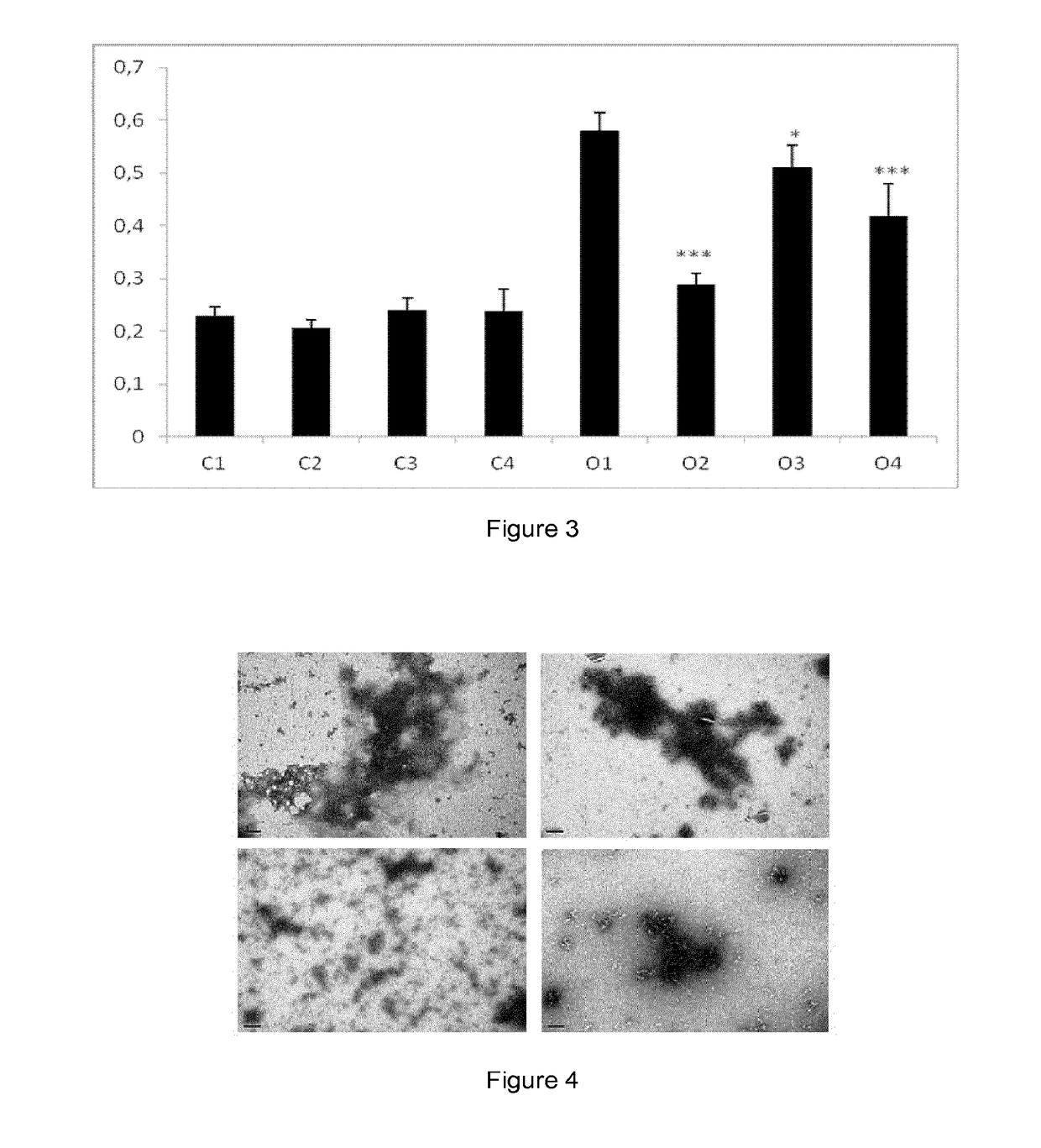 New Therapy for Transthyretin-Associated Amyloidosis