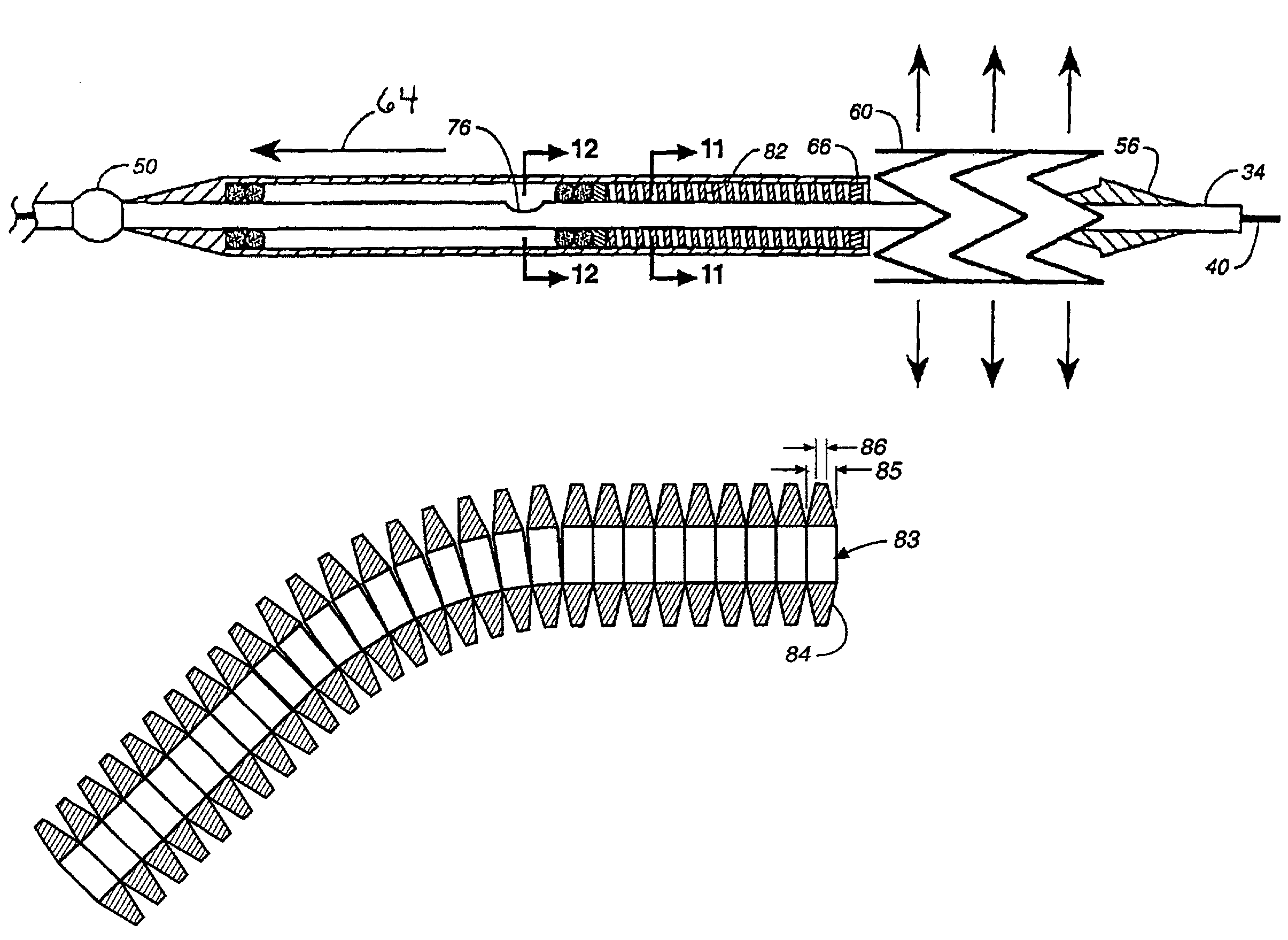 Stent delivery system with hydraulic deployment
