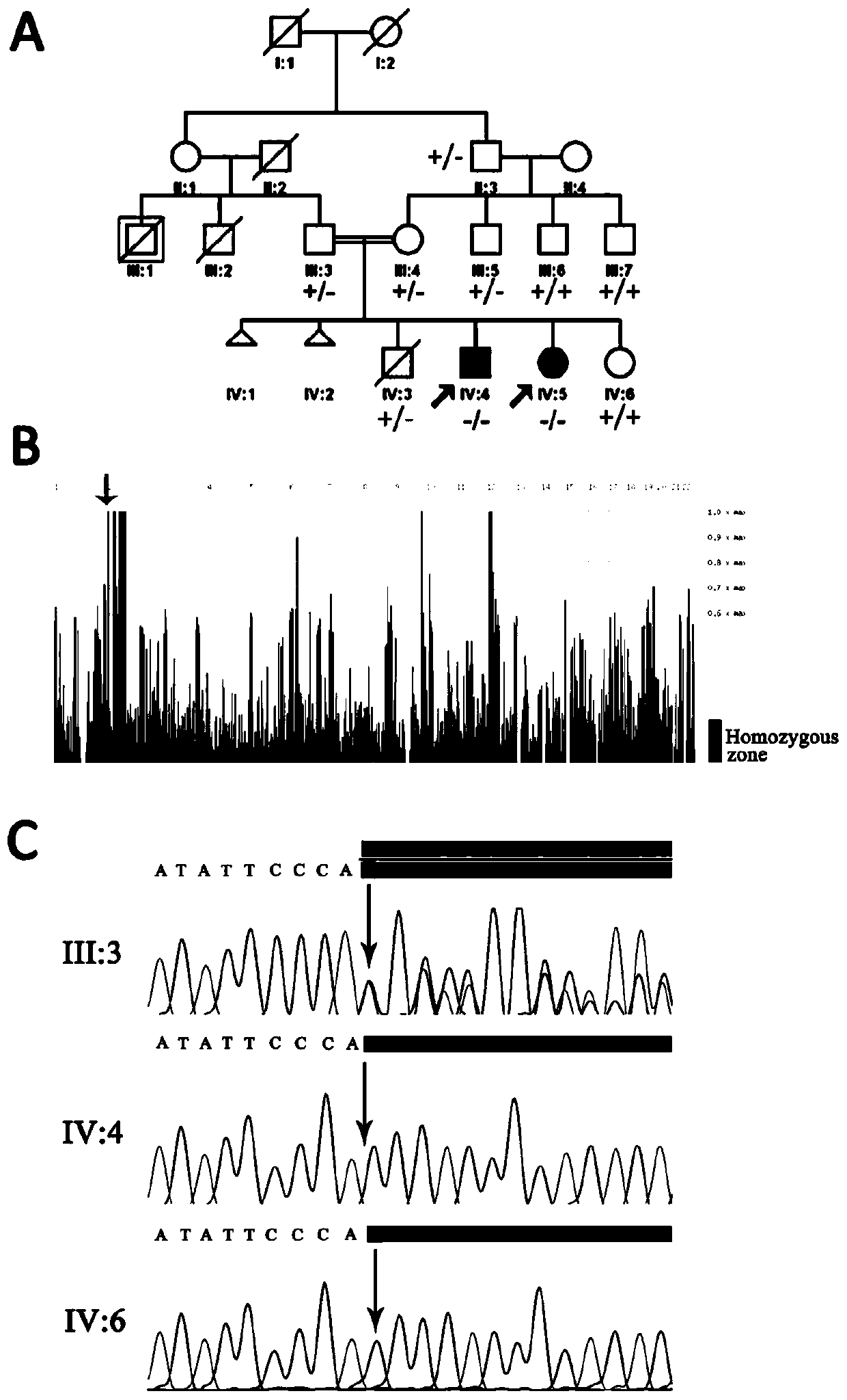 Application of ZNF124 gene in early screening or auxiliary diagnosis of retinal pigment degeneration disease