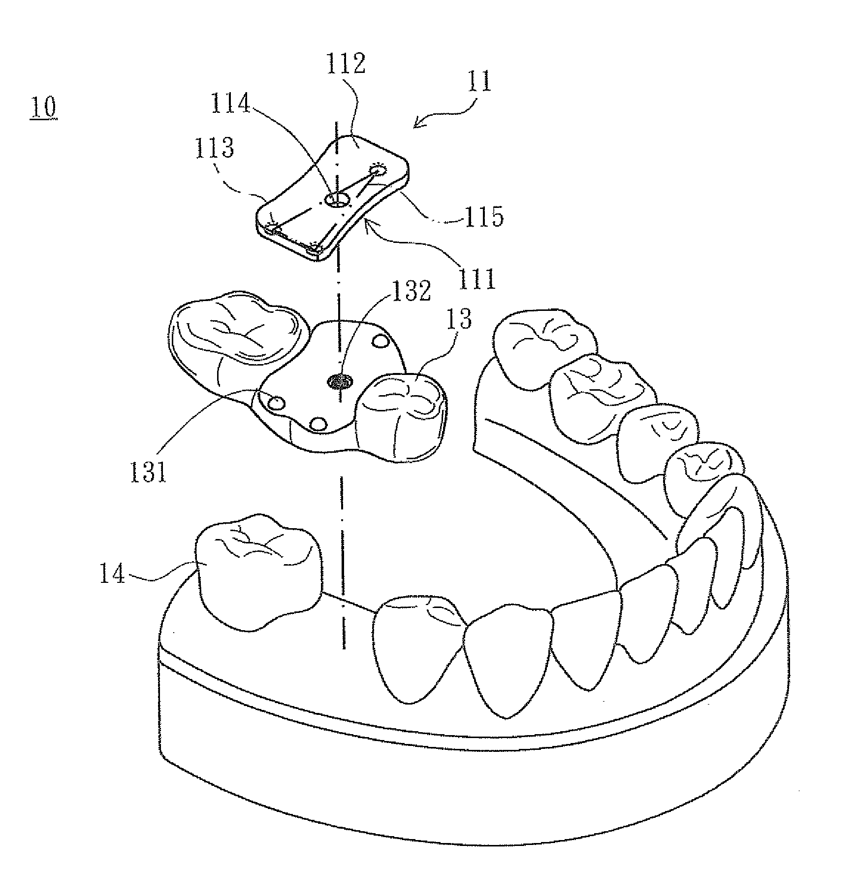 Method of manufacturing surgical template positioning device