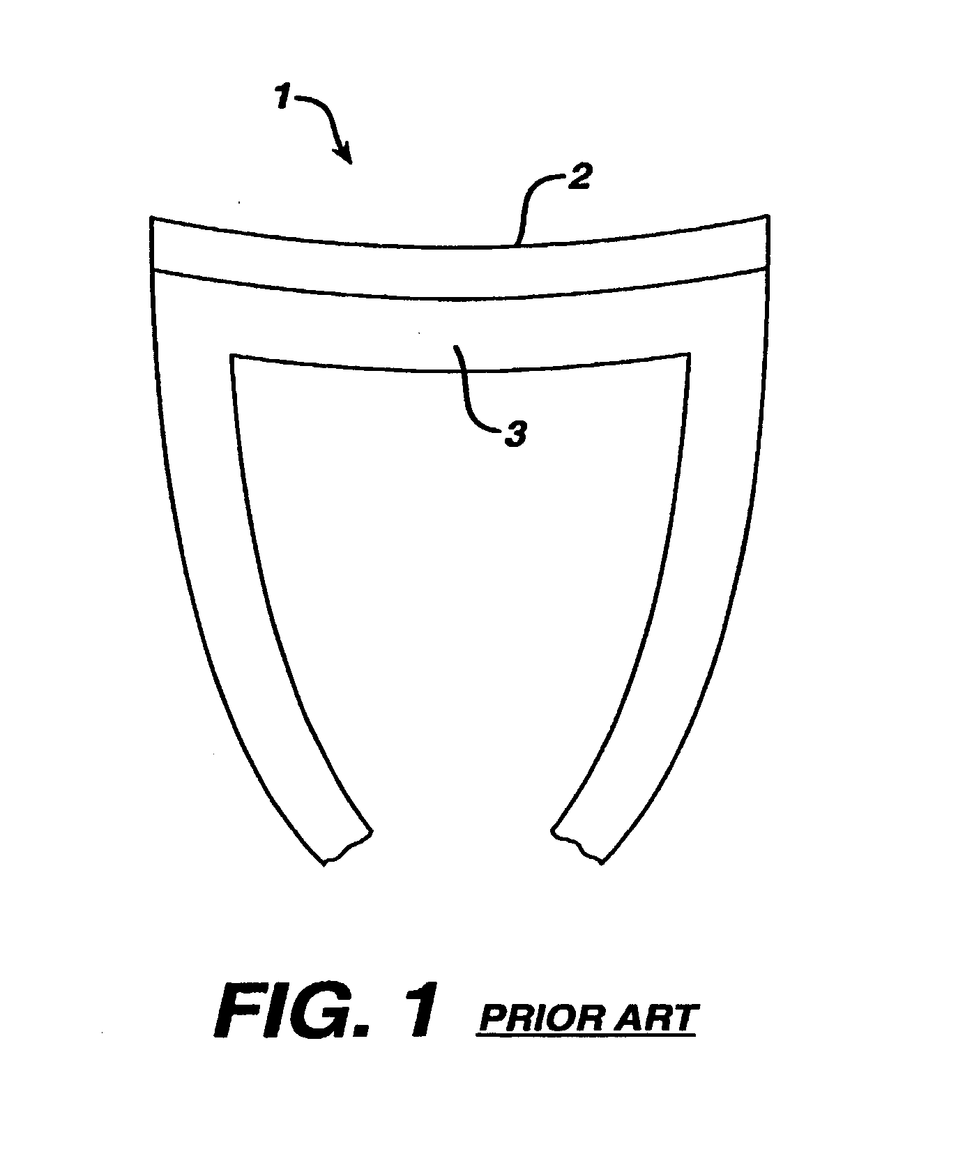 Tamp for concave resurfacing prosthesis