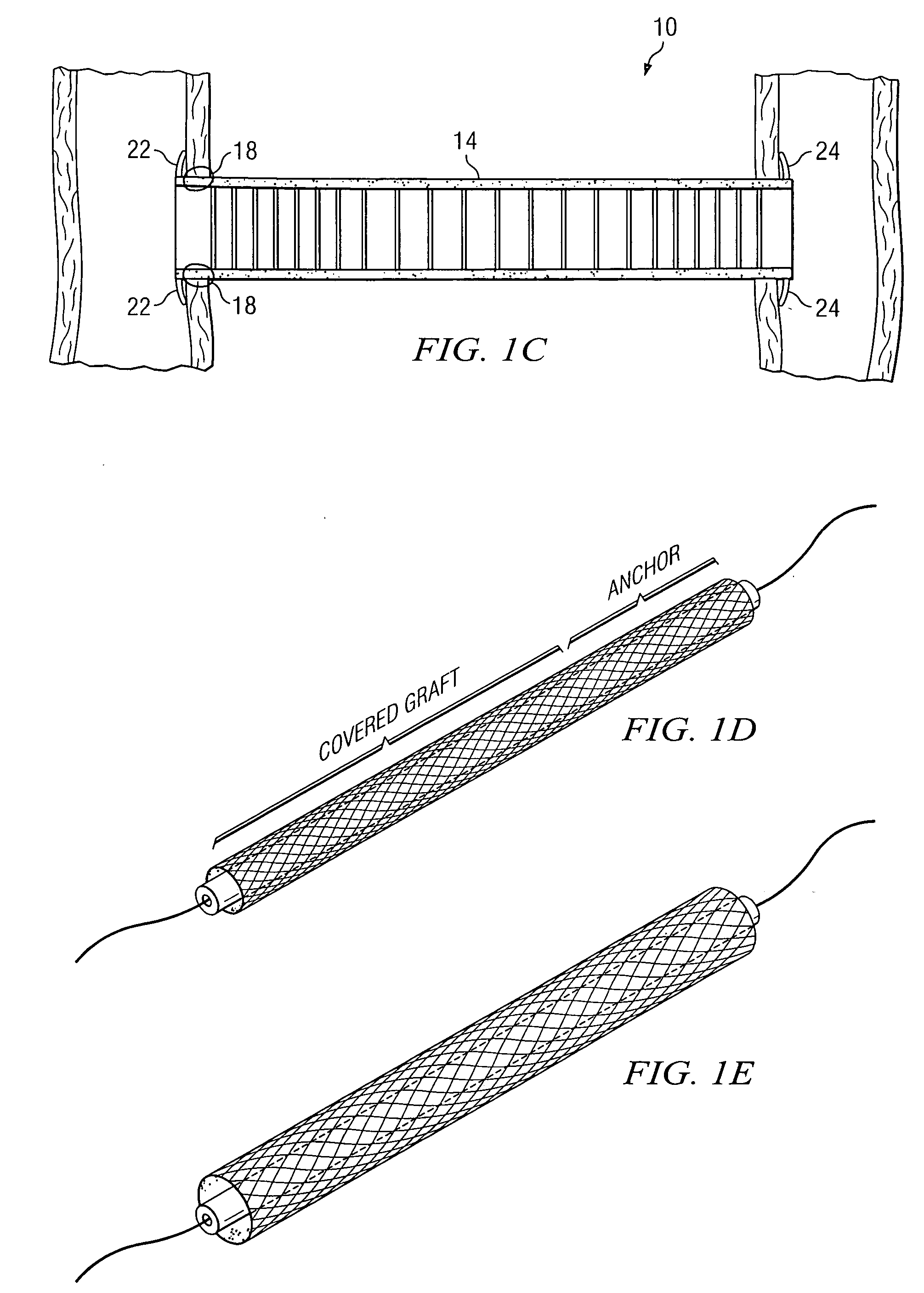 System and method for providing a graft in a vascular environment