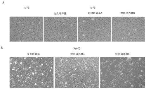 A kind of human vascular endothelial cell culture medium and culture method thereof