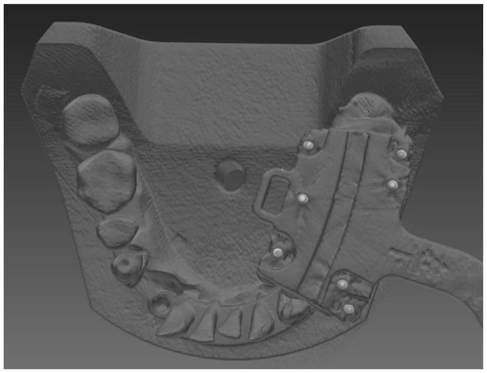 Oral implant precision evaluation method and system and terminal equipment