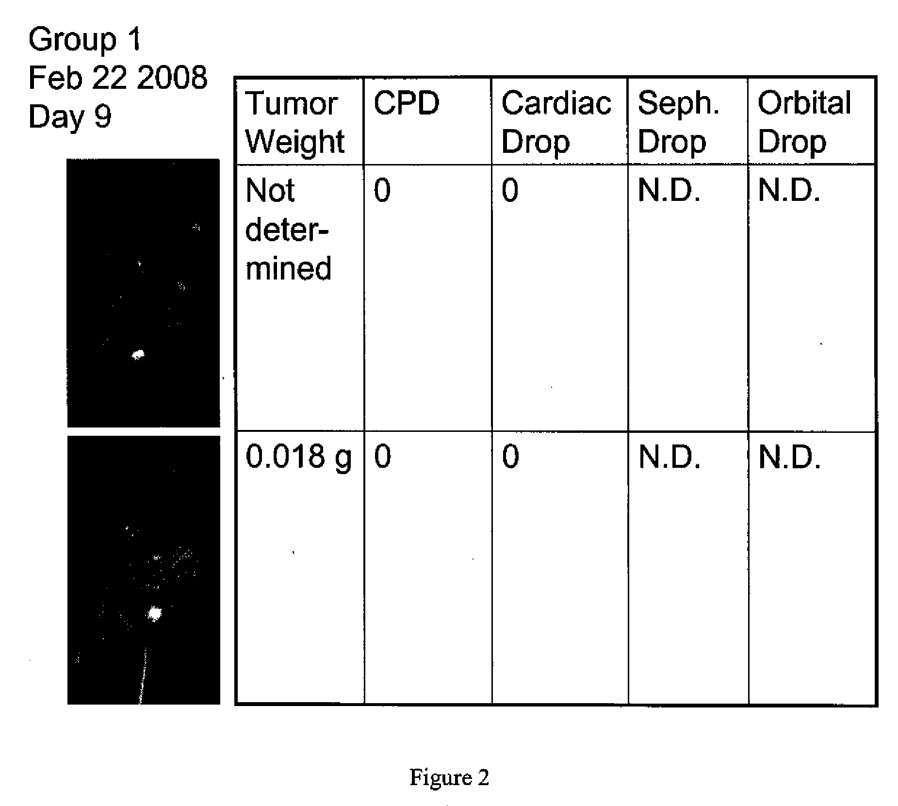 Methods for Diagnosing Cancer Using Samples Collected From A Central Vein Location or an Arterial Location