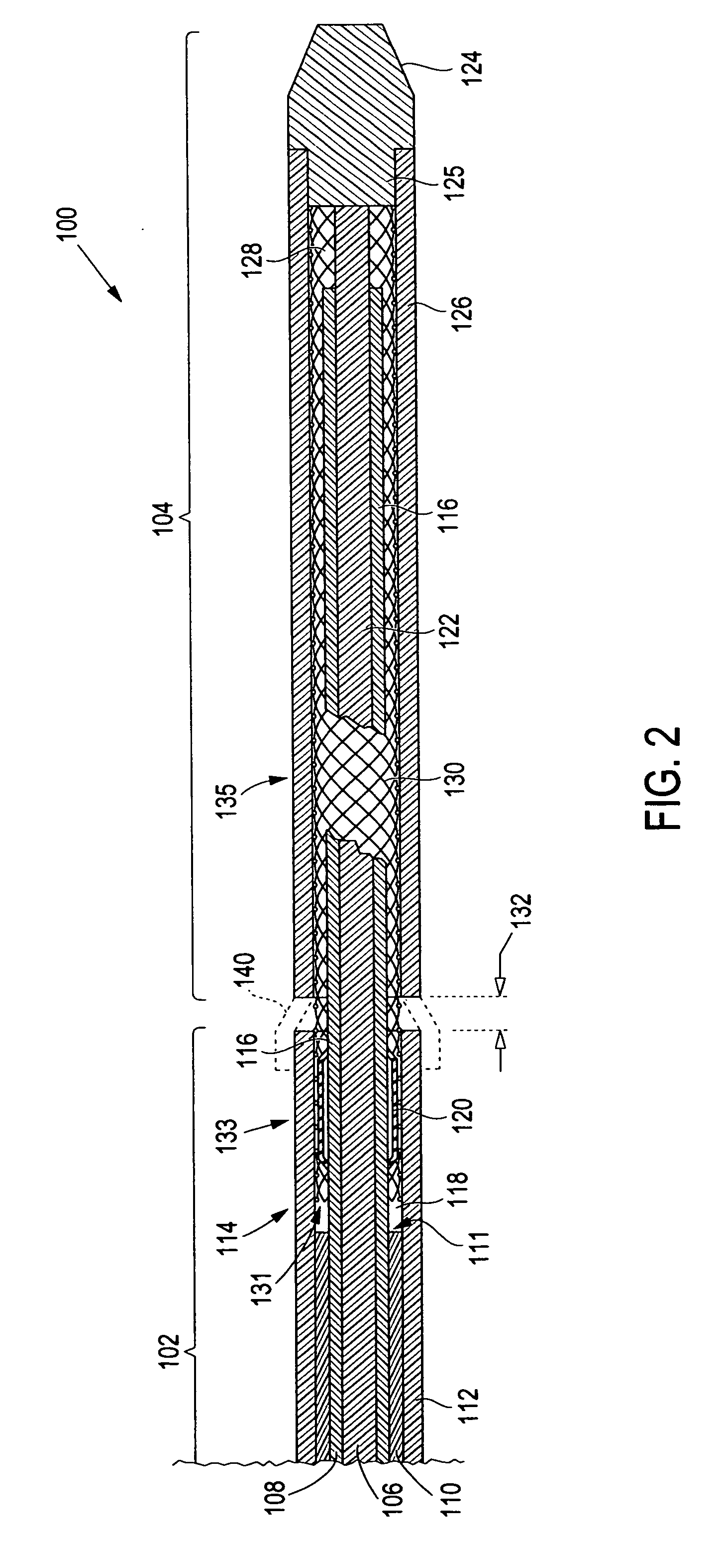 Method and apparatus for deployment of an endoluminal device