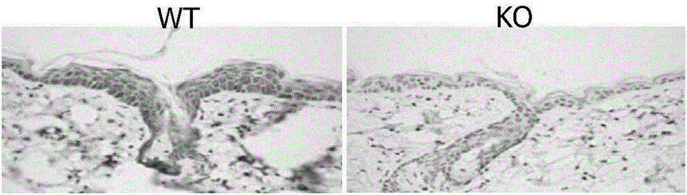 Application of gene knockout animal as skin barrier function disorder animal model