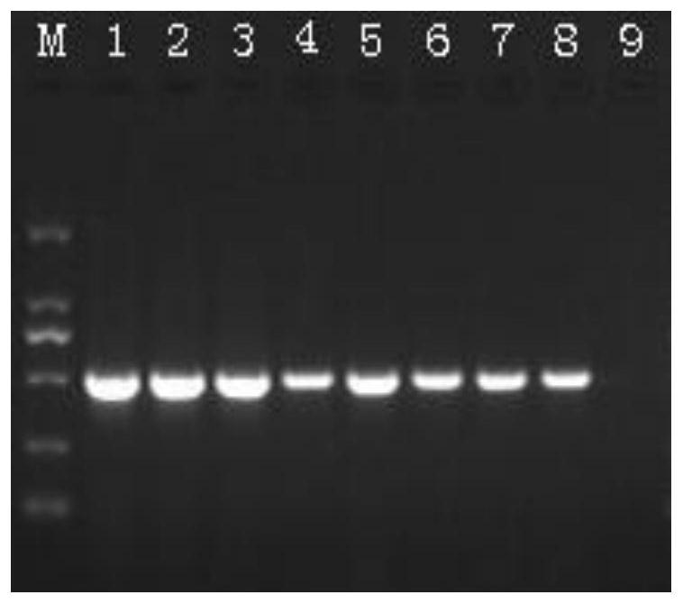 Duplex PCR (polymerase chain reaction) detection method and kit for simultaneously detecting shrimp enterocytozoon hepatopenaei and tetrapod iridovirus 1