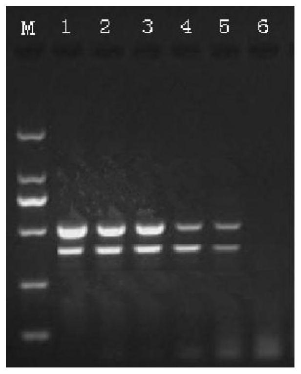 Duplex PCR (polymerase chain reaction) detection method and kit for simultaneously detecting shrimp enterocytozoon hepatopenaei and tetrapod iridovirus 1