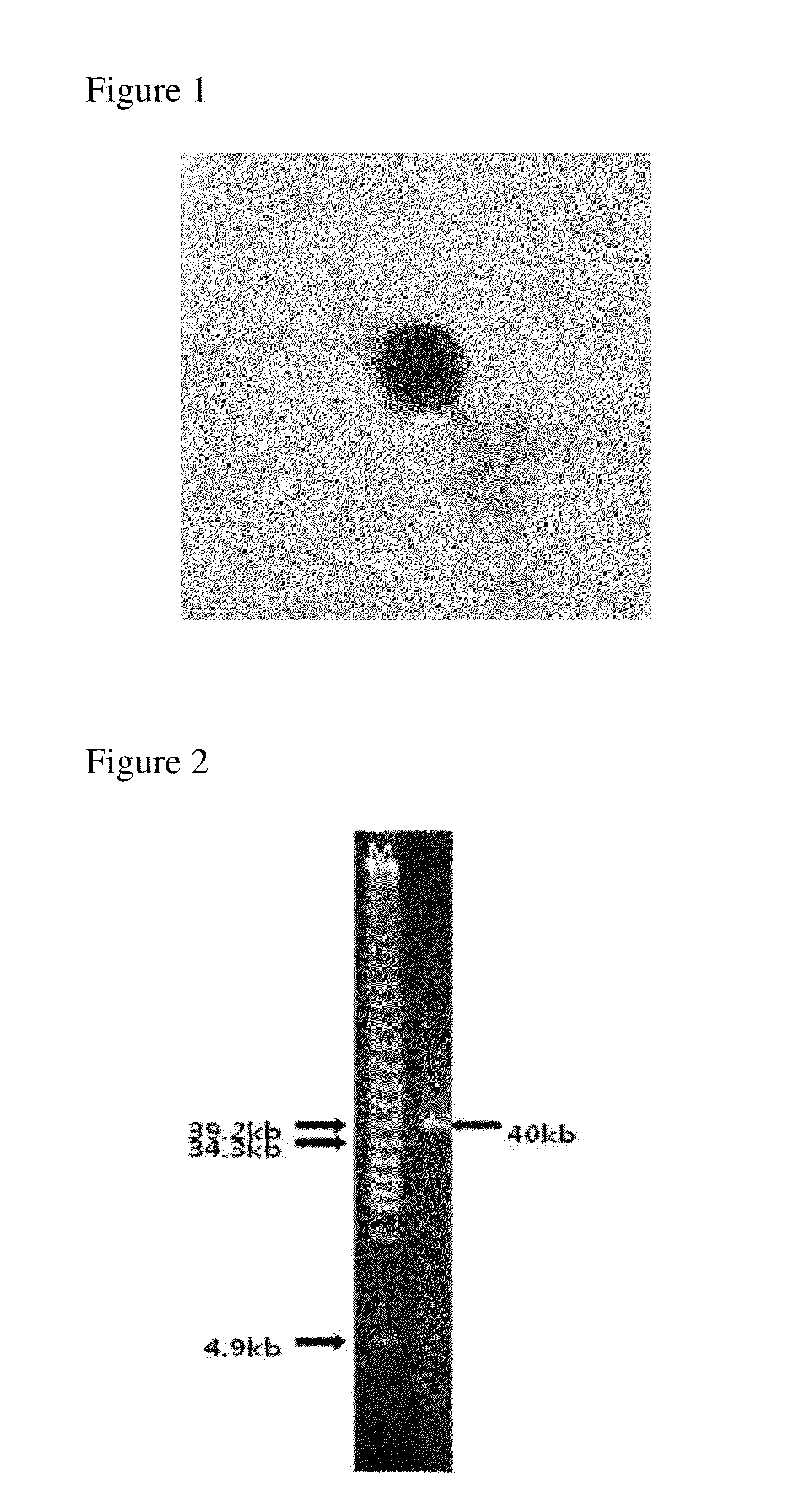 Novel bacteriophage and antibacterial composition comprising the same