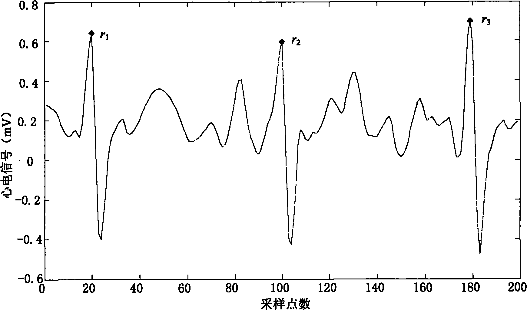 Method for detecting R wave crest of electrocardiosignal