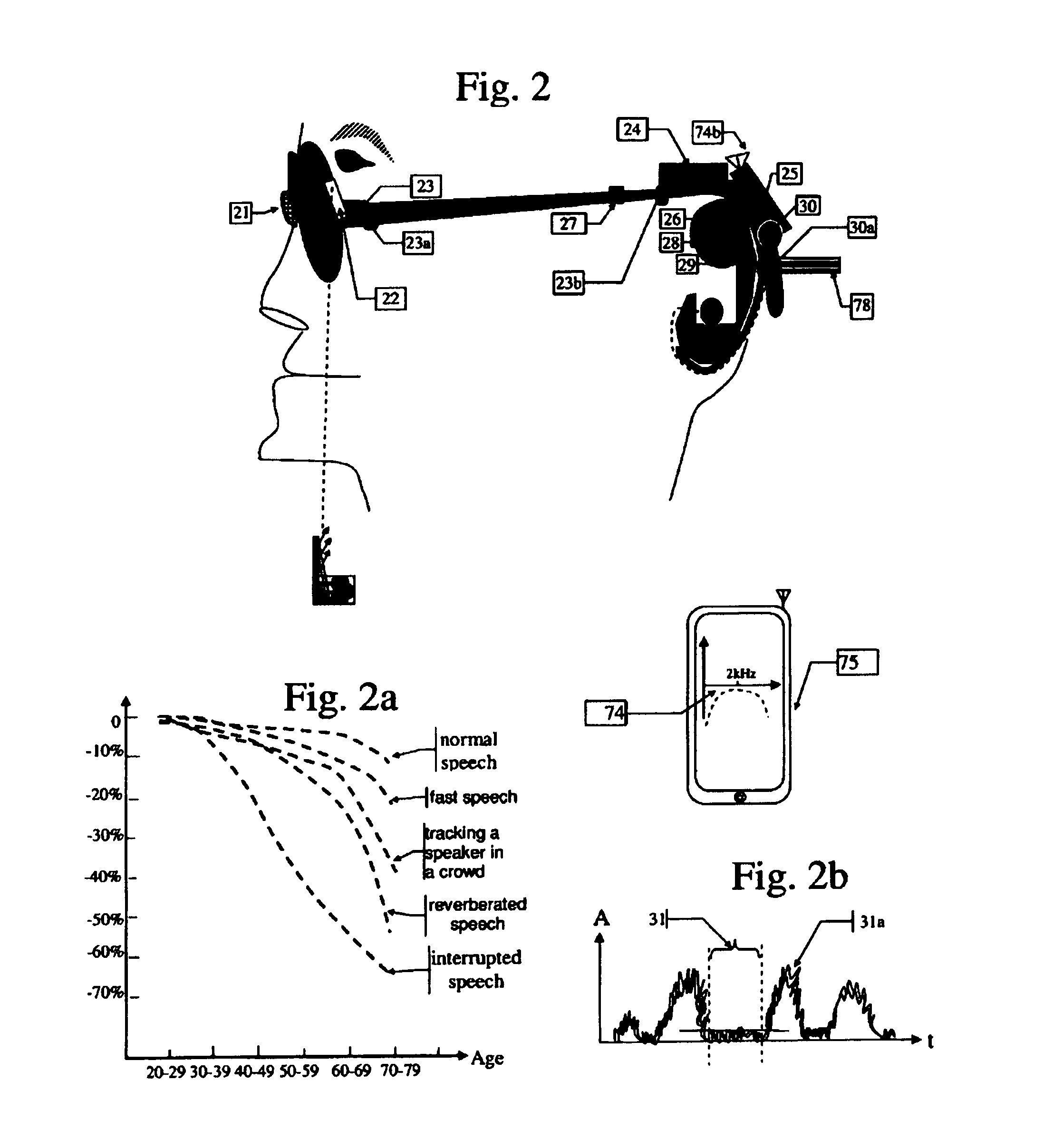 Hearing devices based on the plasticity of the brain