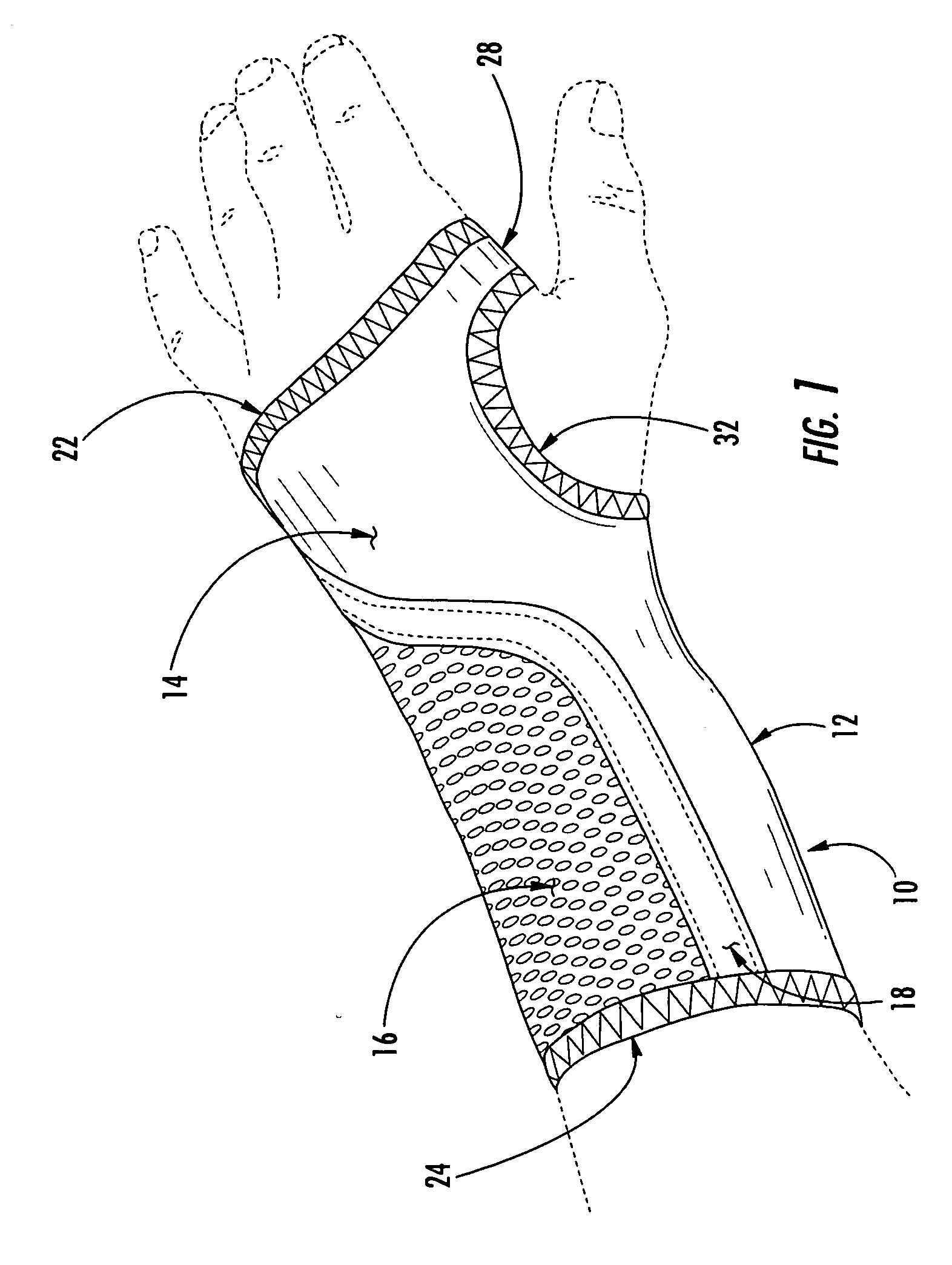 Wrist brace having continuous loop straps and method of using the same