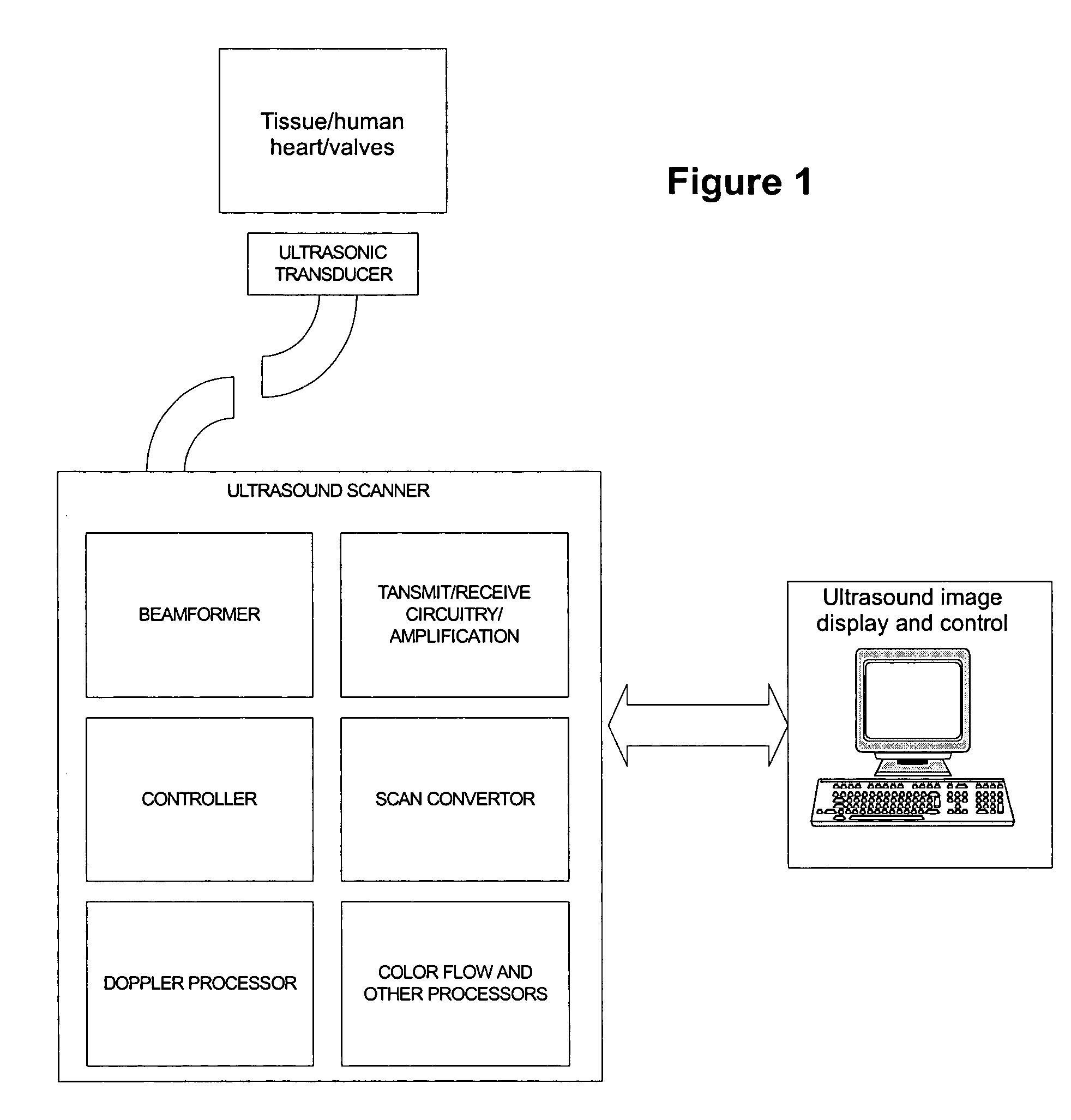 Method and system for using ultrasound in cardiac diagnosis and therapy
