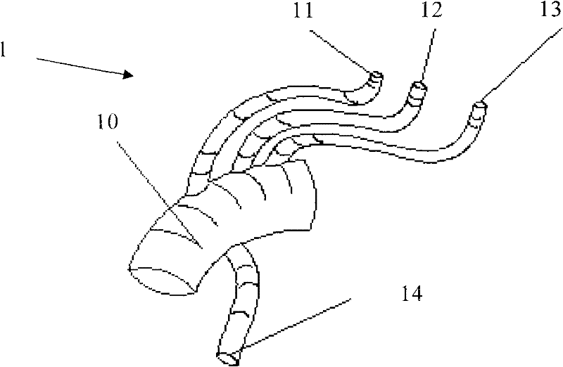 Improved intraoperation stent system