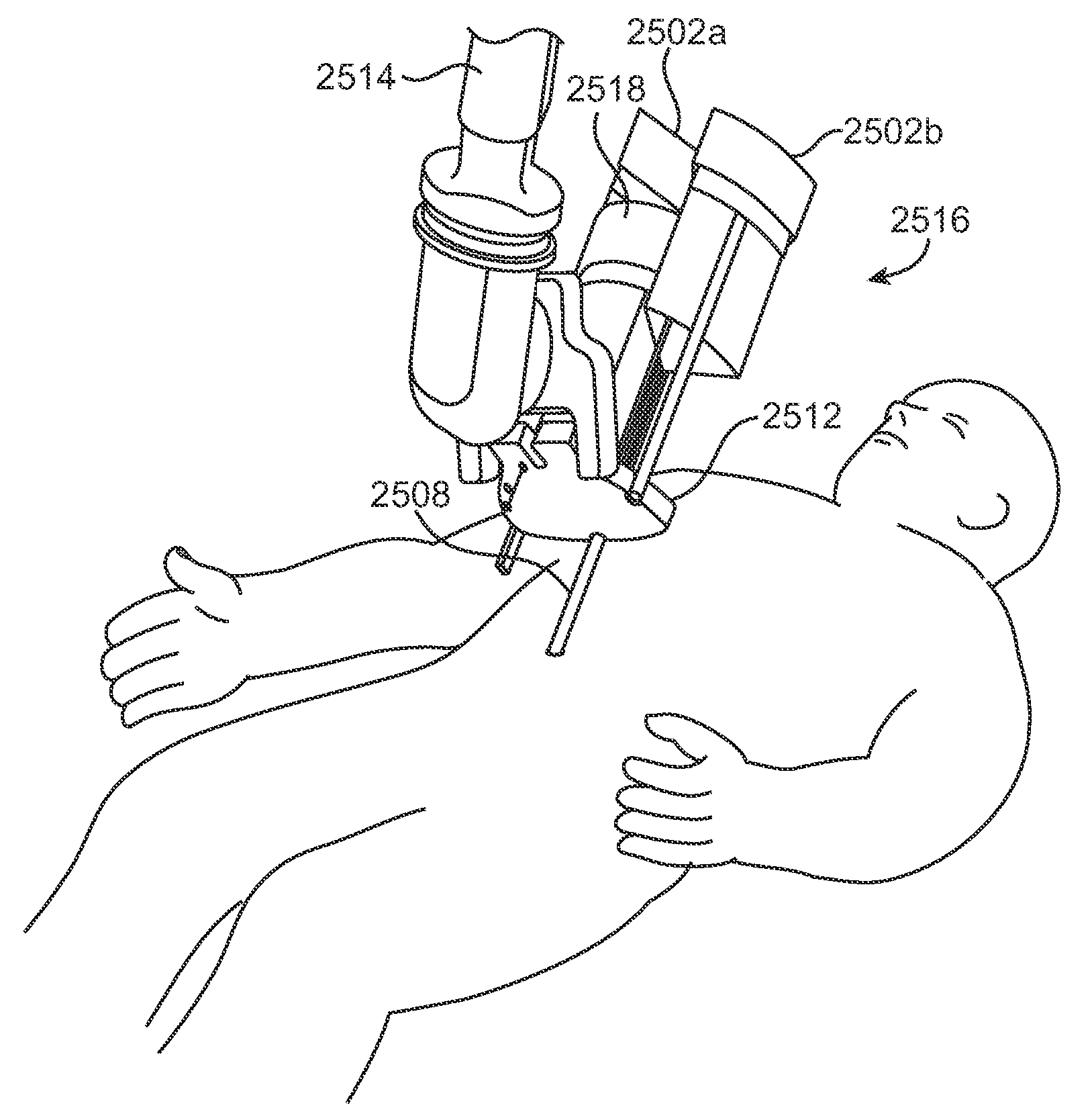 Medical robotic system with coupled control modes