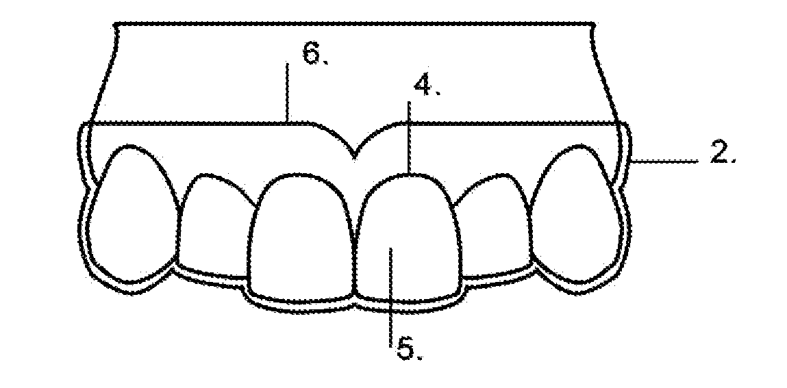 Labial Connector