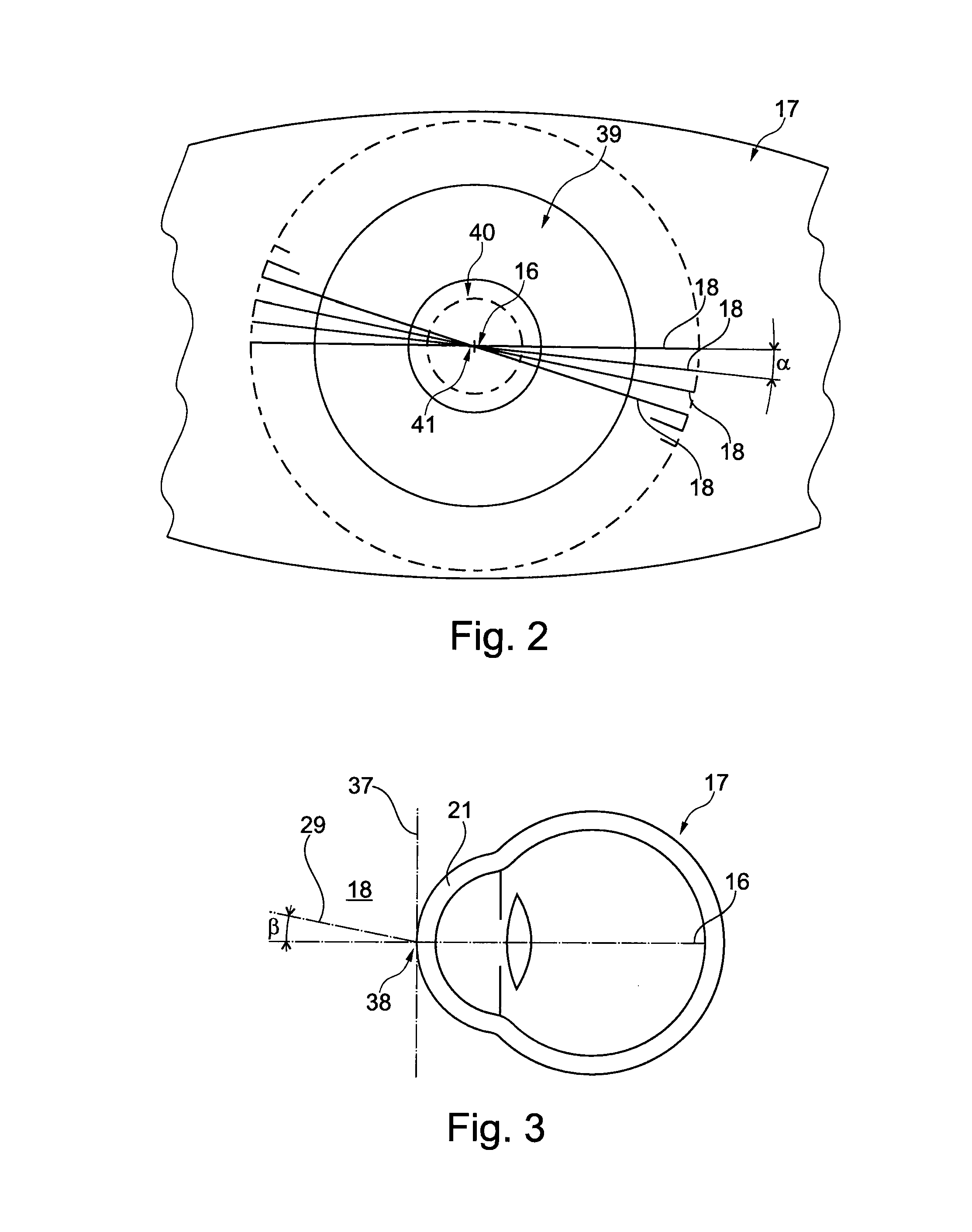 Method and analysis system for eye examinations