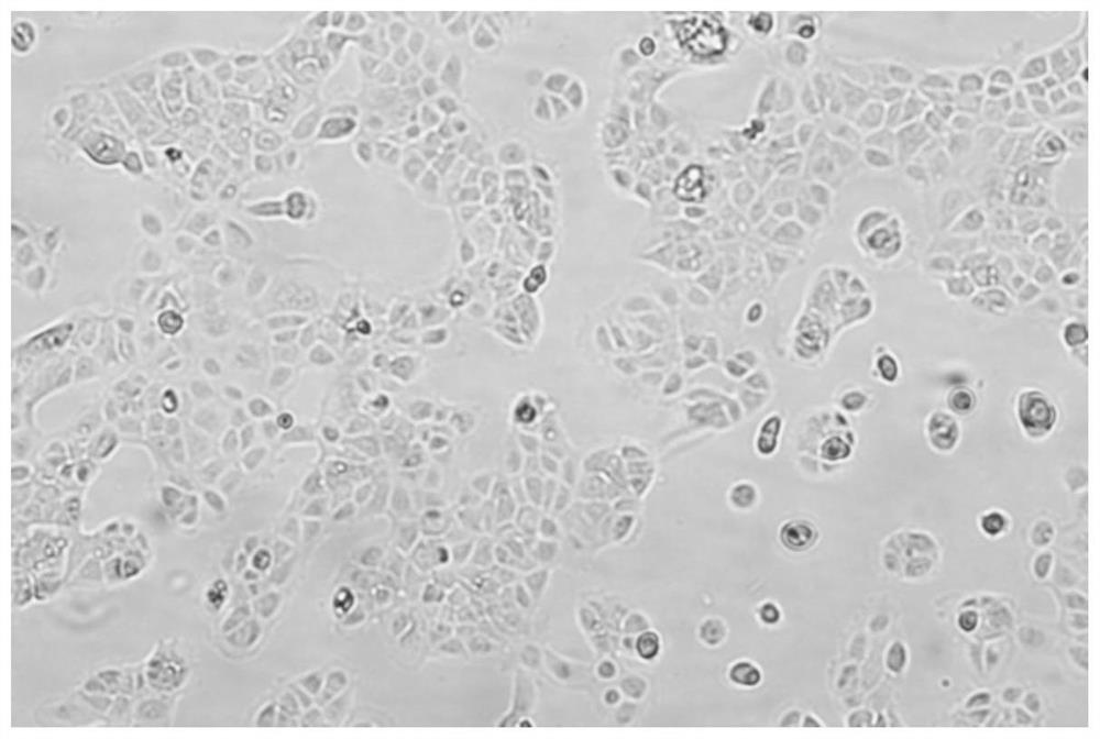 Human ovarian squamous carcinoma cell line and application thereof