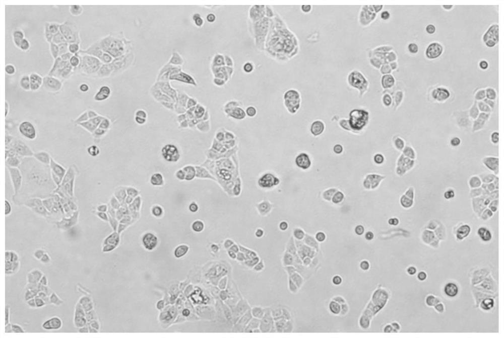 Human ovarian squamous carcinoma cell line and application thereof