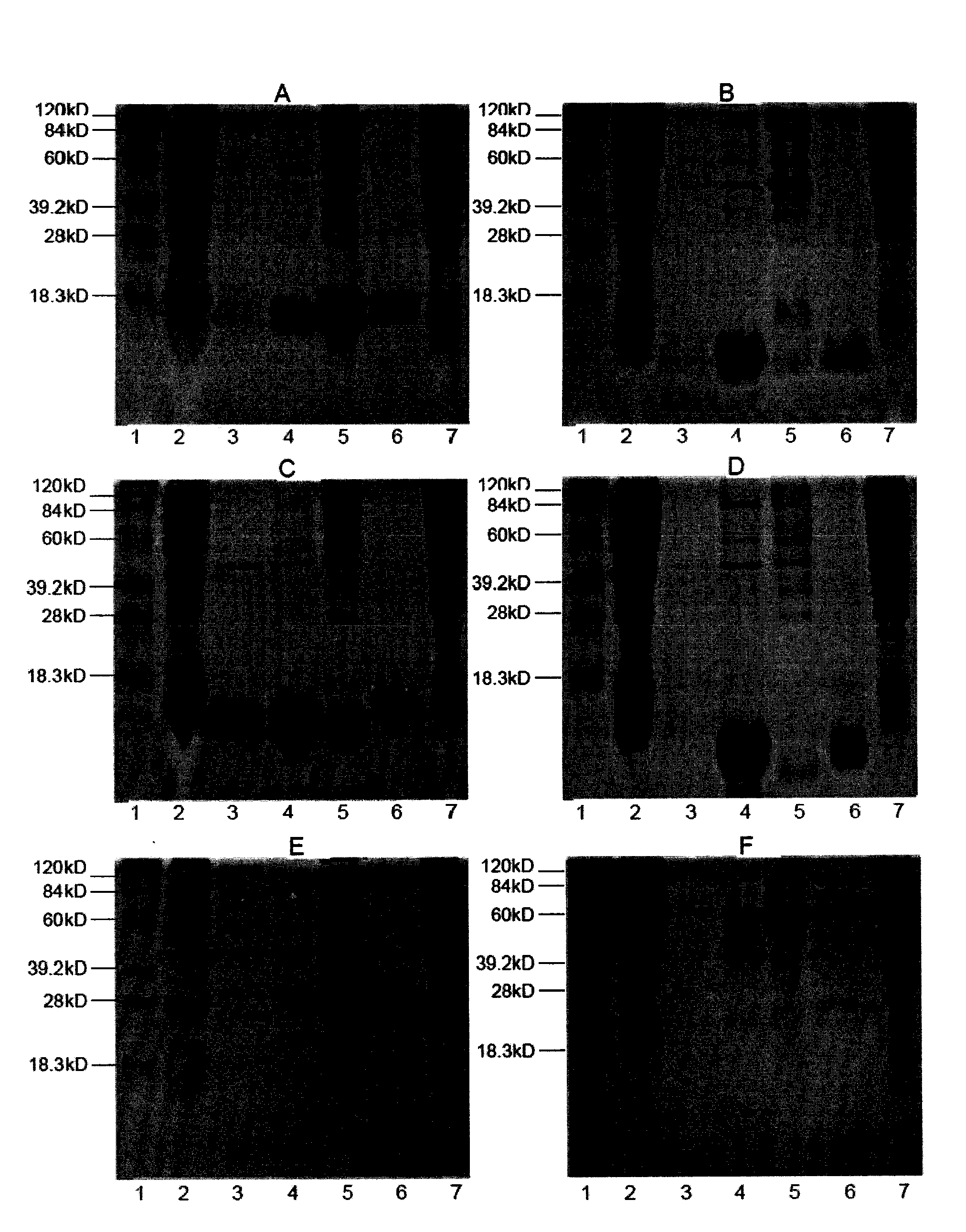 Anti-CD4 protein monoclonal antibody and its active fragment and application