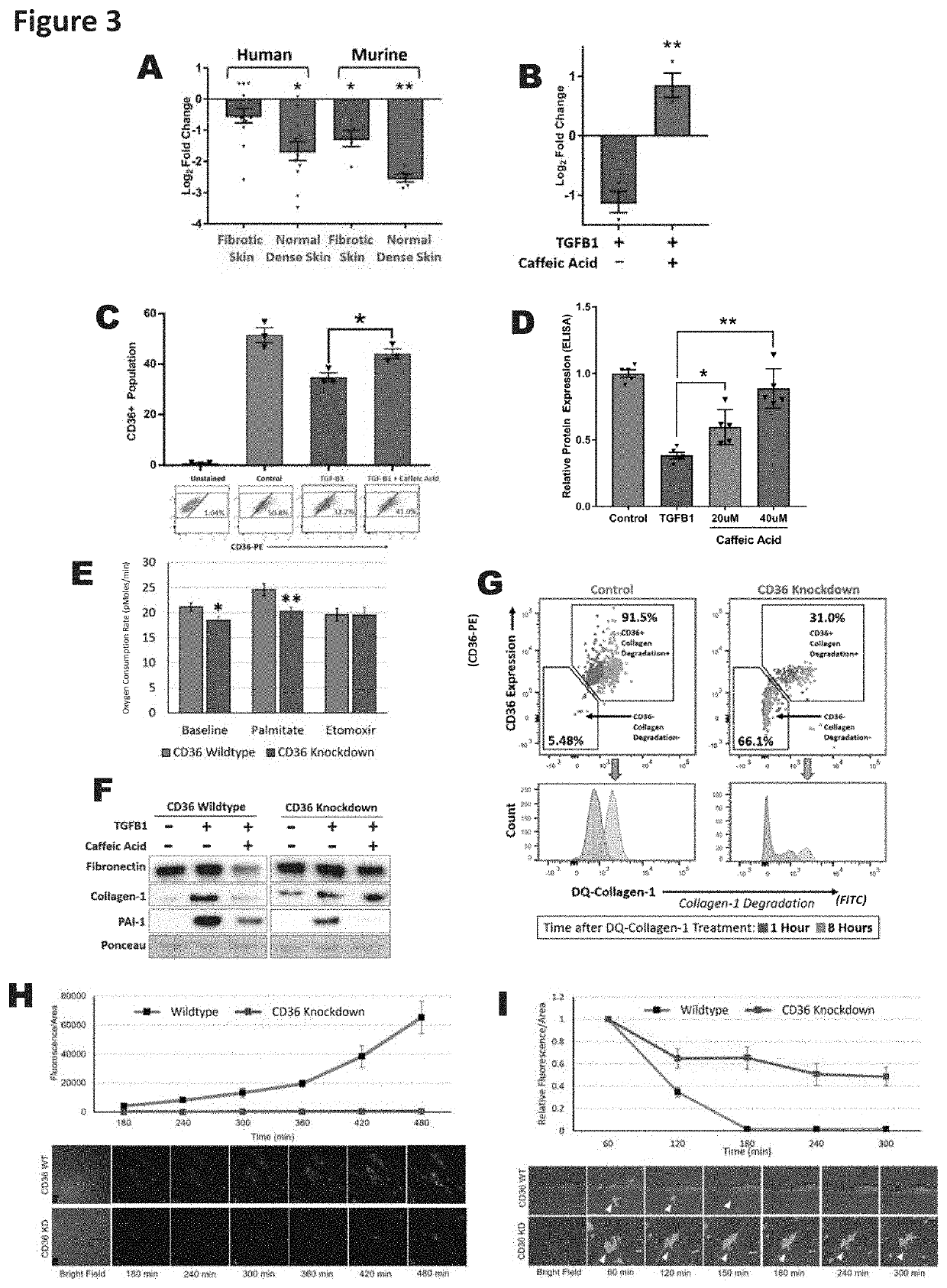 Composition and methods for regulating extracellular matrix accumulation