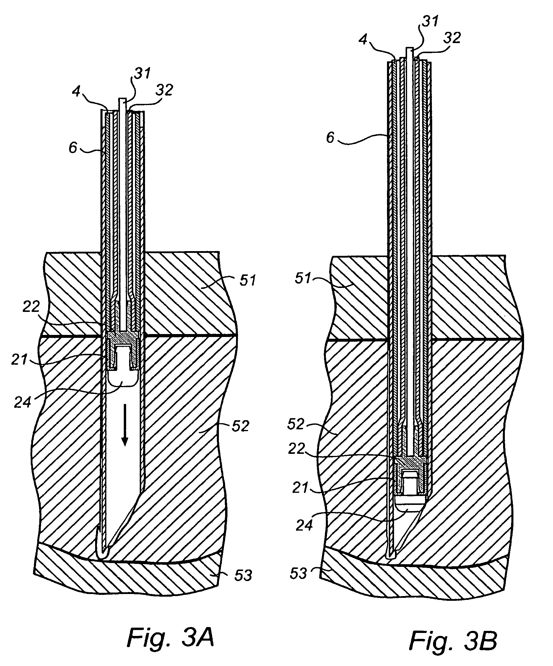 Electrode for Implantation in a Living Organ and a Method for Implanting the Elecrode