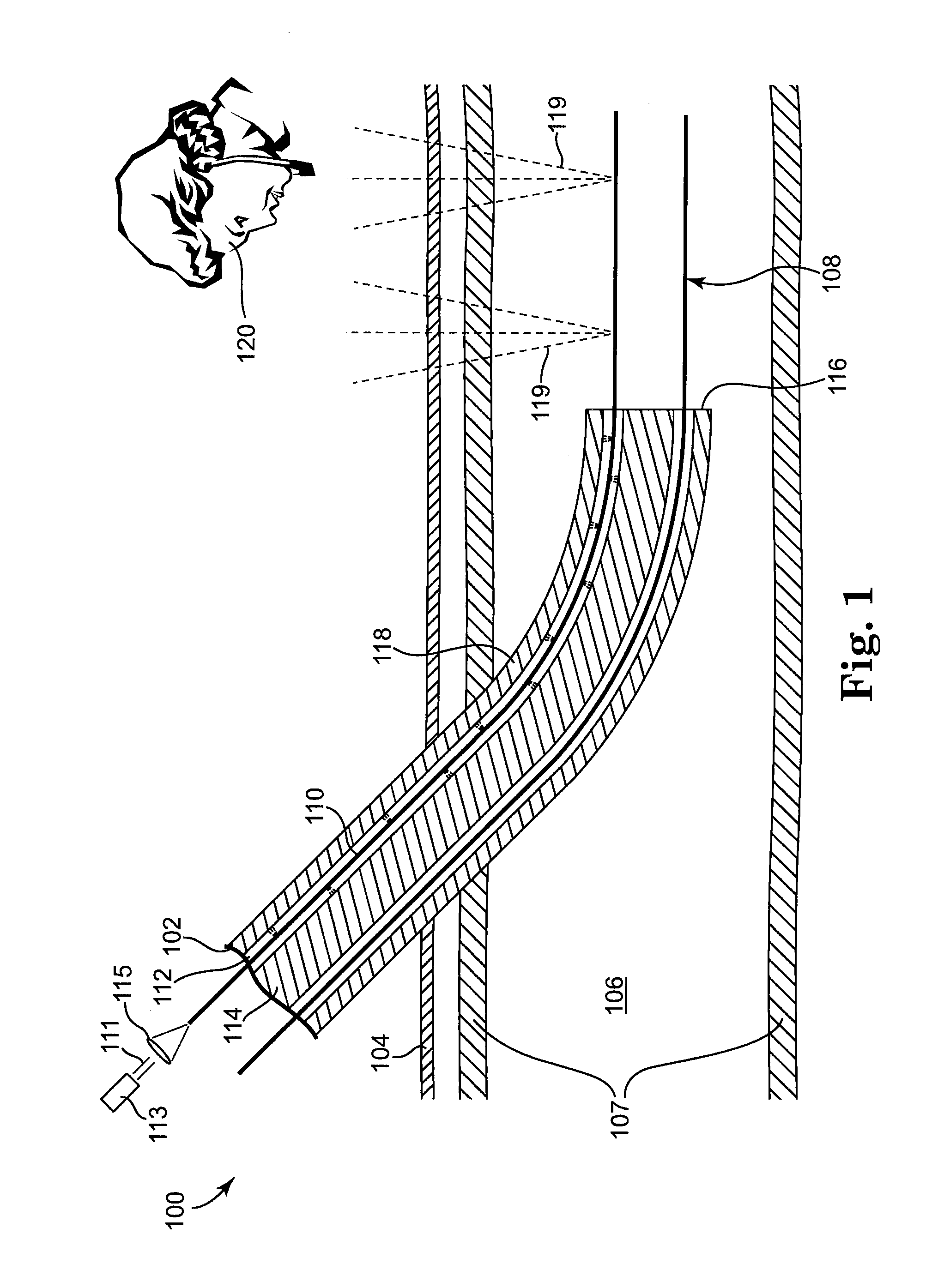 Light-guided transluminal catheter