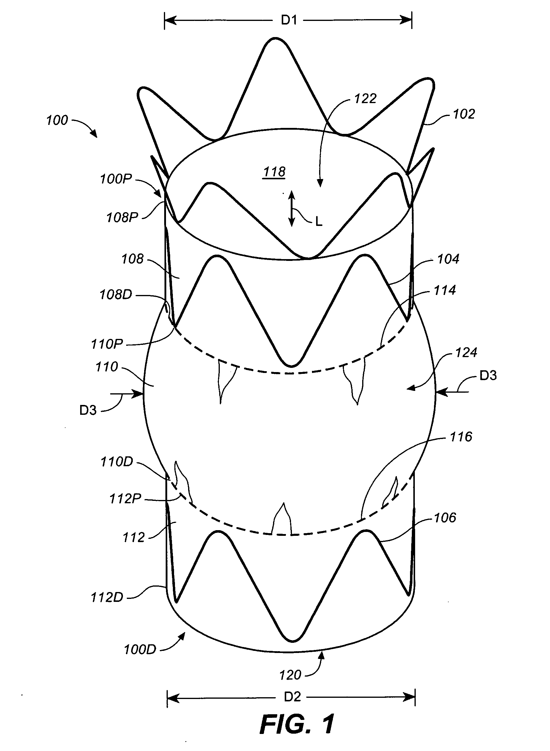 Bloused Stent-Graft and Fenestration Method