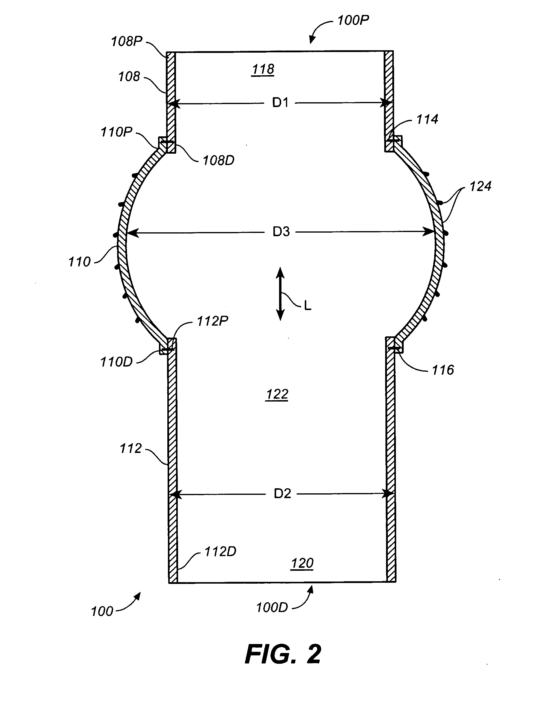 Bloused Stent-Graft and Fenestration Method