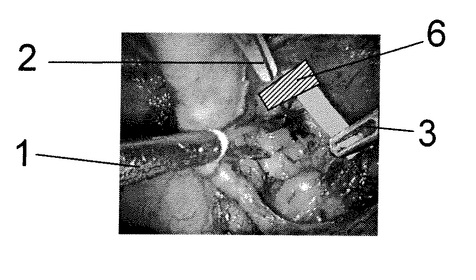 System and method for analysing a surgical operation by endoscopy