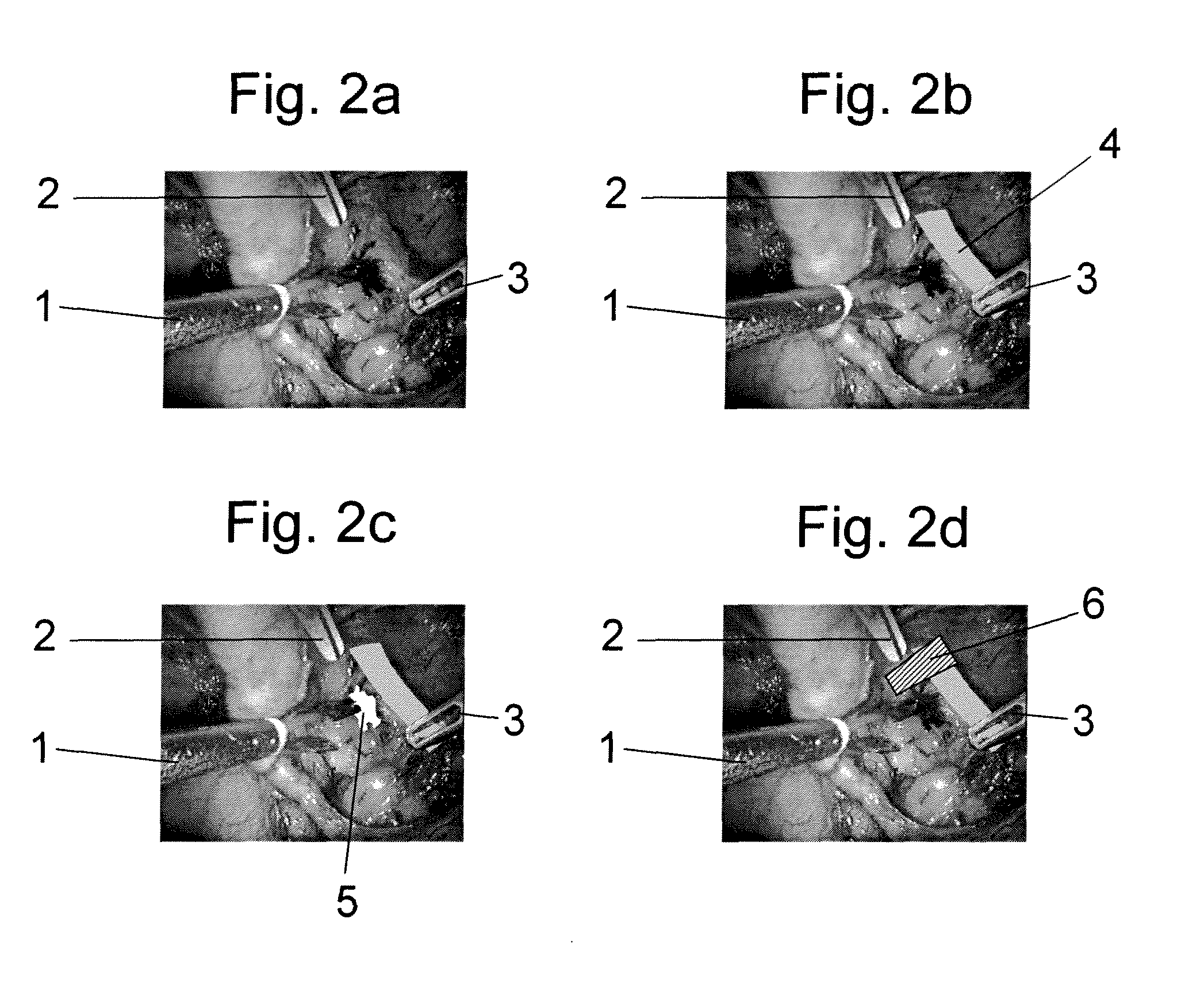 System and method for analysing a surgical operation by endoscopy