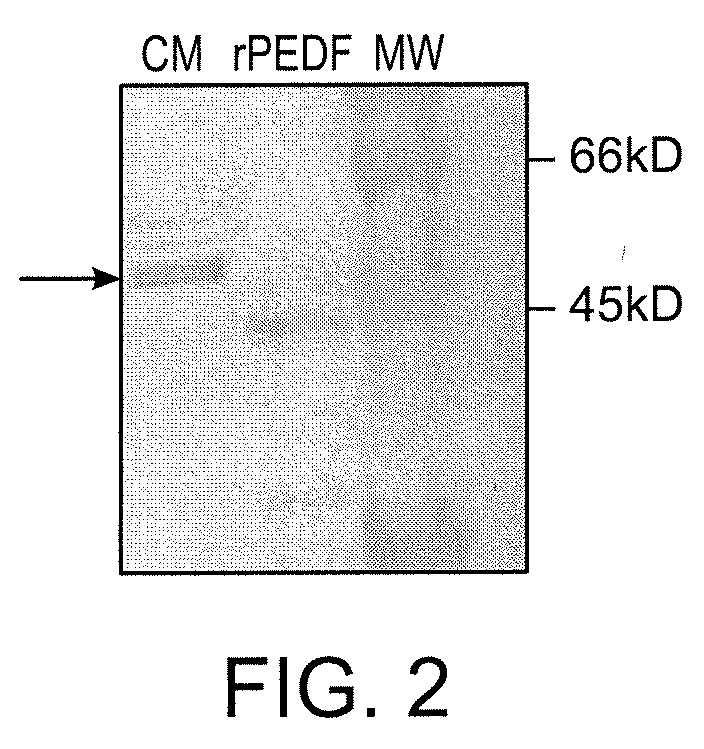 Use of PEDF in an Encapsulated Cell-Based Delivery System