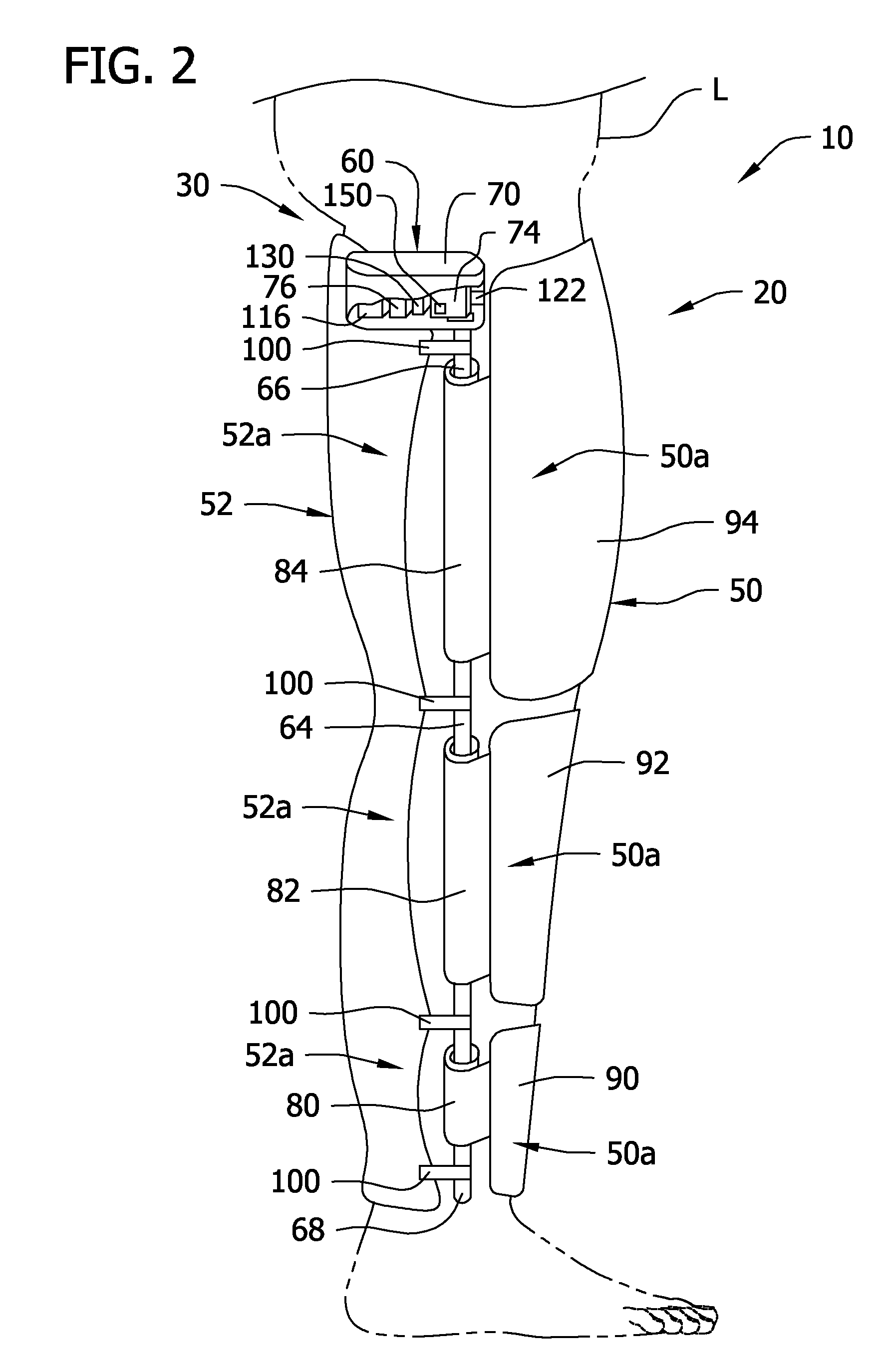 Portable, self-contained compression device