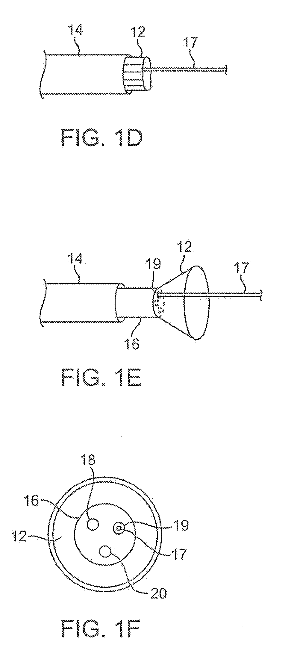 Methods and apparatus for treatment of atrial fibrillation