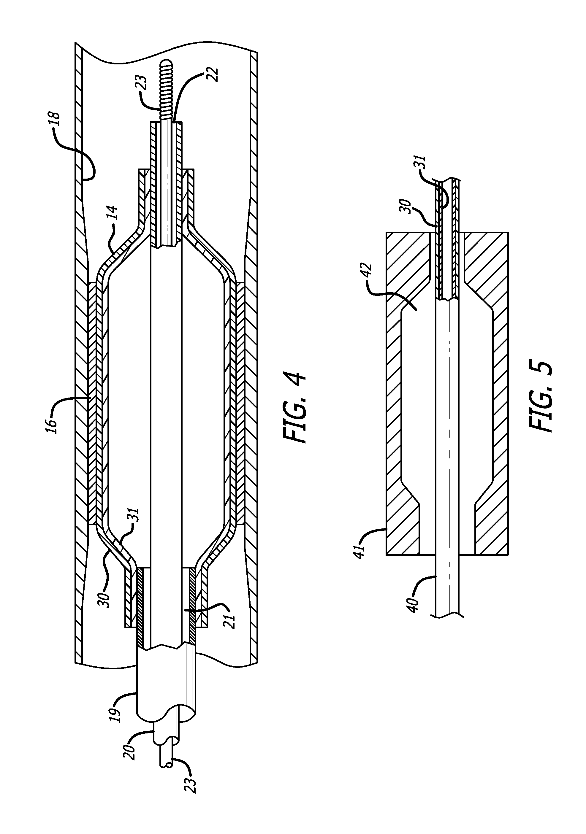 Catheter balloon and method for forming same