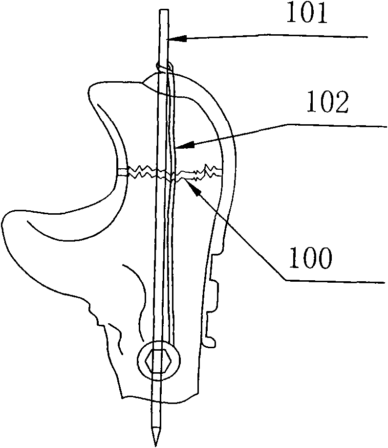 Olecroanon locking proximal humerus plate