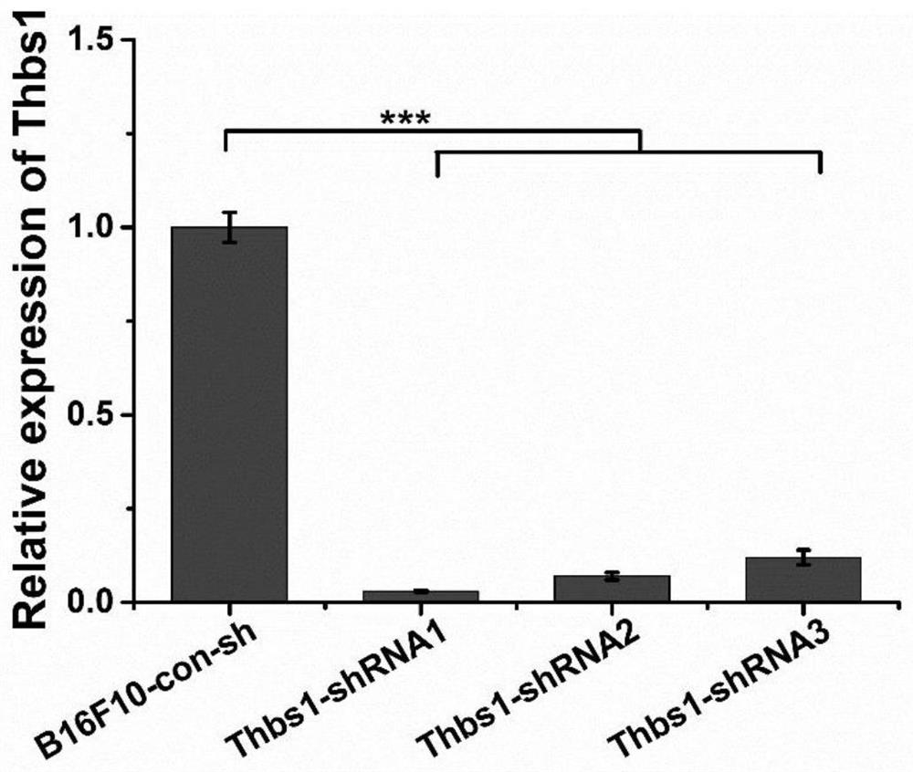 Application of thbs1 and its inhibitors in the preparation of antitumor drugs