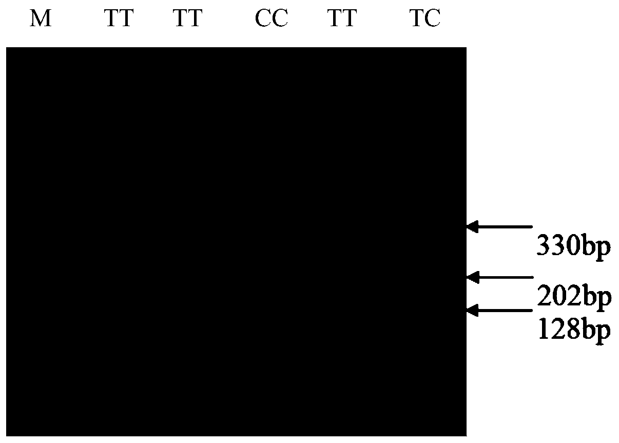 Pig 5-aminolevulinic acid synthase 1 gene as genetic marker of pig litter size traits and application thereof