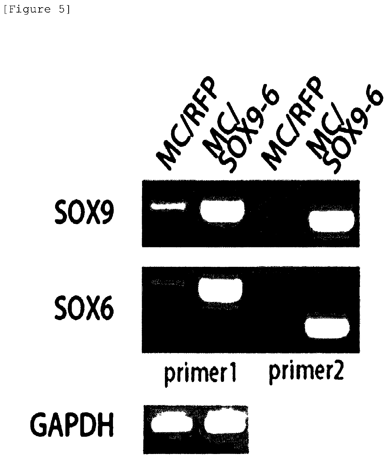 Nonviral minicircle vector carrying SOX gene and construction method therefor