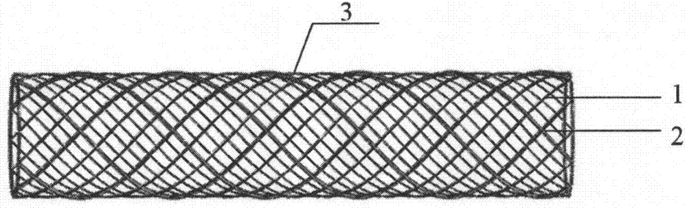 A braided integrated vascular stent graft and preparation method thereof
