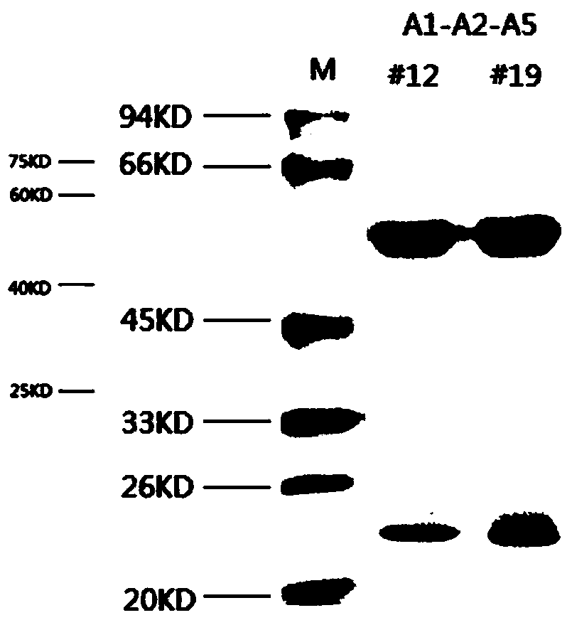 Hybridoma cell strain and anti-Wnt5a monoclonal antibody produced thereby as well as application thereof